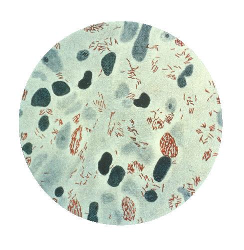 Een afbeelding van de staafvormige leprabacterie: kleine rode streepjes. In een groenige cirkel. Er drijven ook donkerblauwe figuren rond.